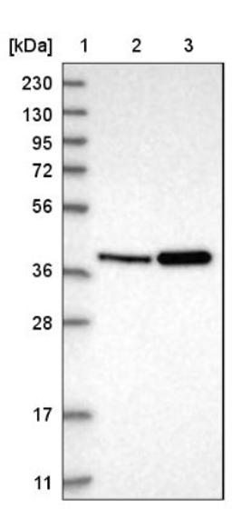 Western Blot: PECI Antibody [NBP1-89283] - Lane 1: Marker [kDa] 230, 130, 95, 72, 56, 36, 28, 17, 11<br/>Lane 2: Human cell line RT-4<br/>Lane 3: Human cell line U-251MG sp