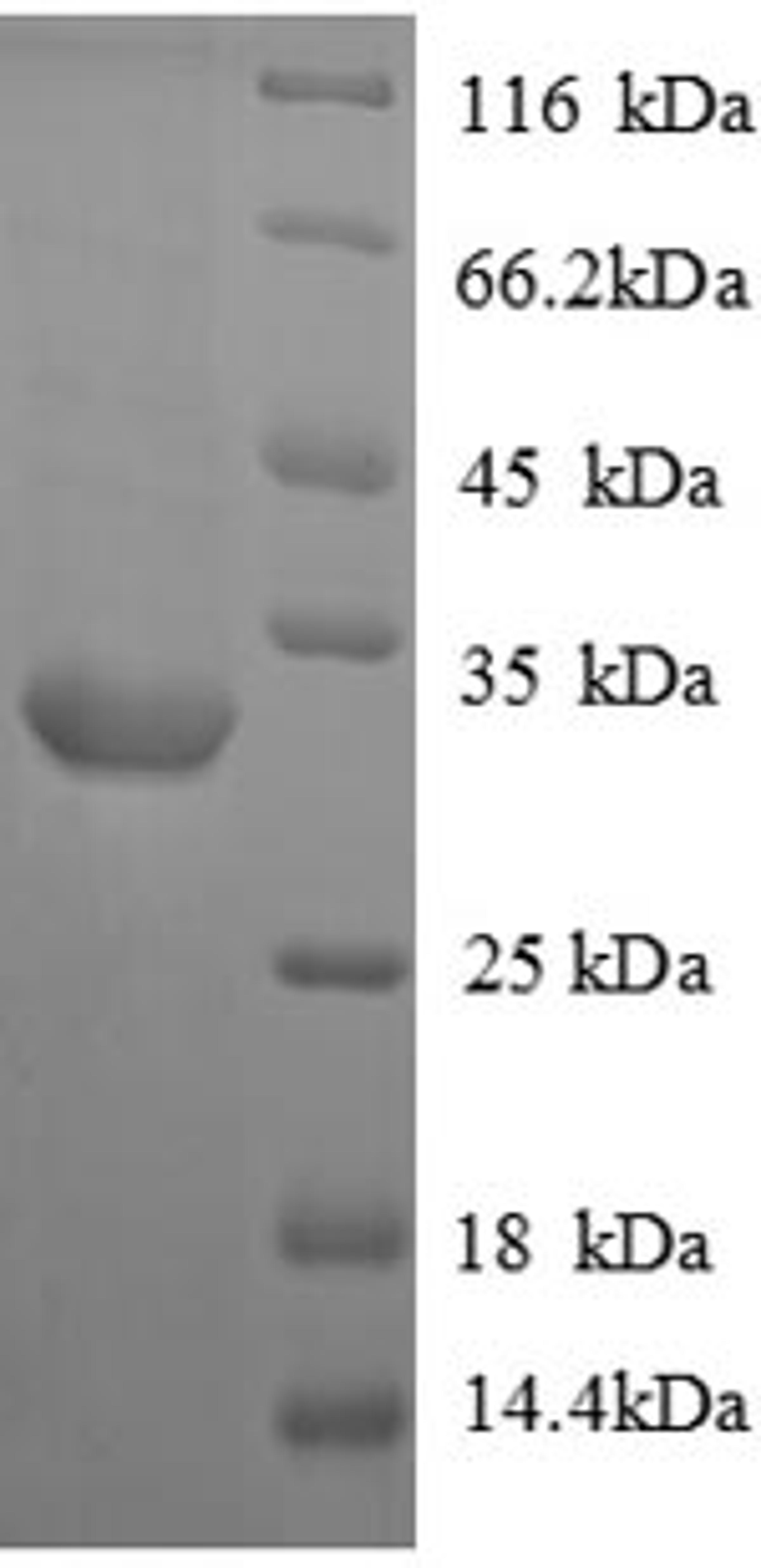 (Tris-Glycine gel) Discontinuous SDS-PAGE (reduced) with 5% enrichment gel and 15% separation gel.