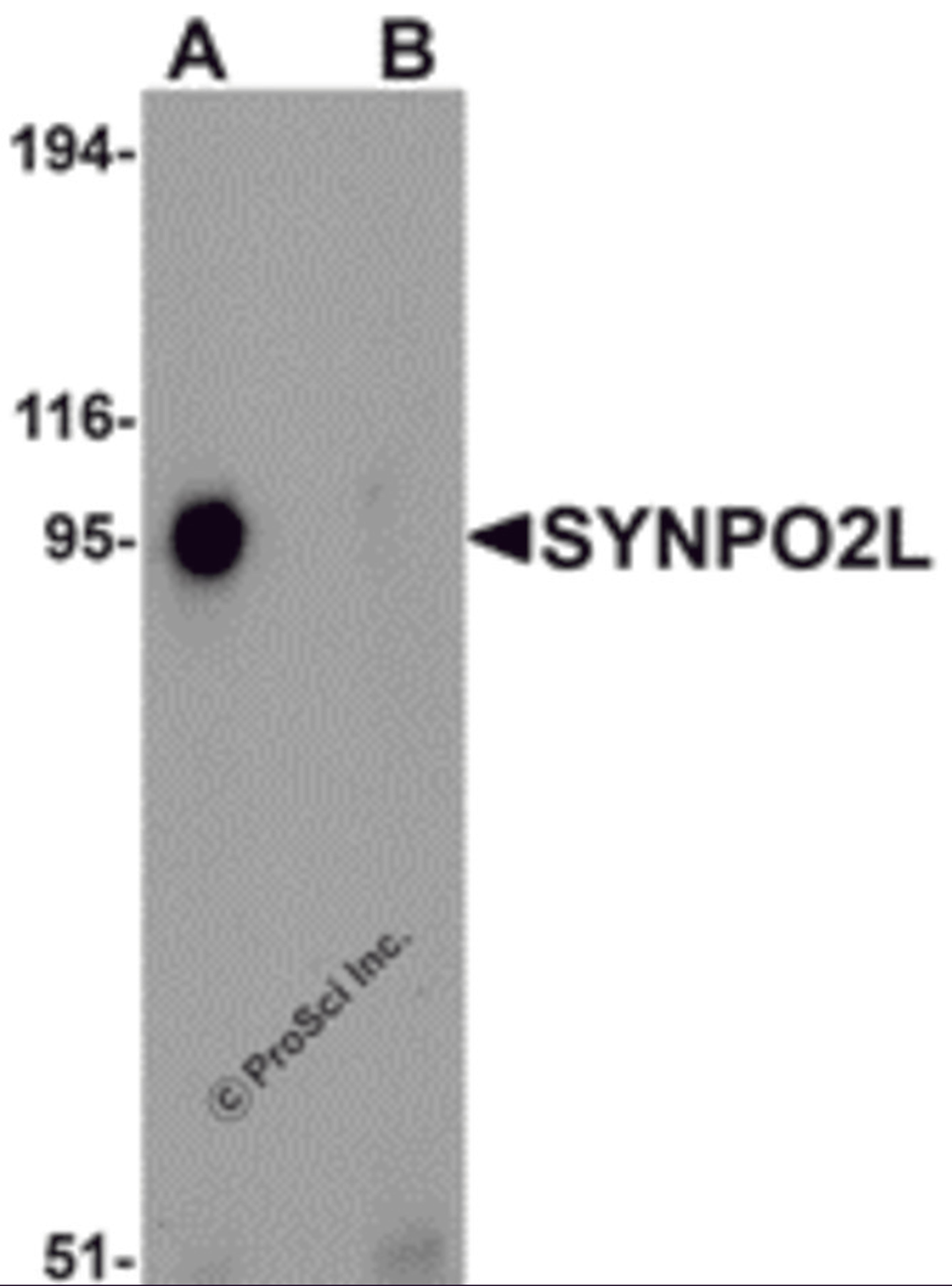 Western blot analysis of SYNPO2L in human thymus tissue lysate with SYNPO2L antibody at 1 &#956;g/mL in (A) the absence and (B) the presence of blocking peptide.