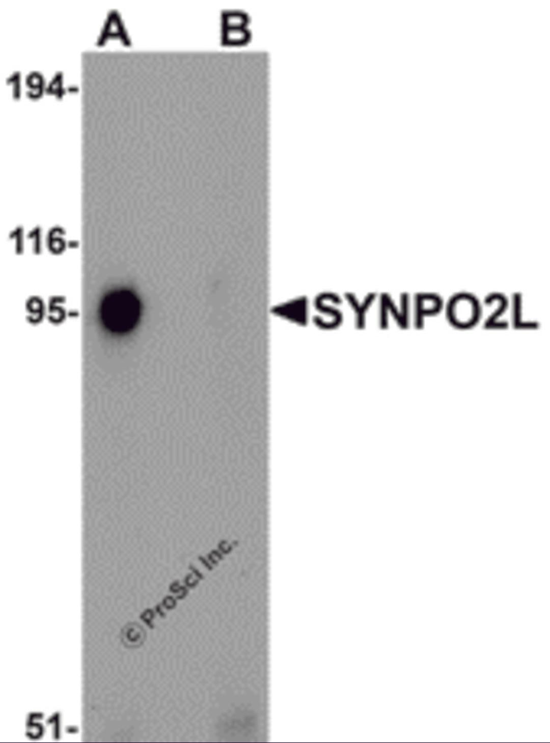 Western blot analysis of SYNPO2L in human thymus tissue lysate with SYNPO2L antibody at 1 μg/mL in (A) the absence and (B) the presence of blocking peptide.