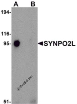 Western blot analysis of SYNPO2L in human thymus tissue lysate with SYNPO2L antibody at 1 μg/mL in (A) the absence and (B) the presence of blocking peptide.