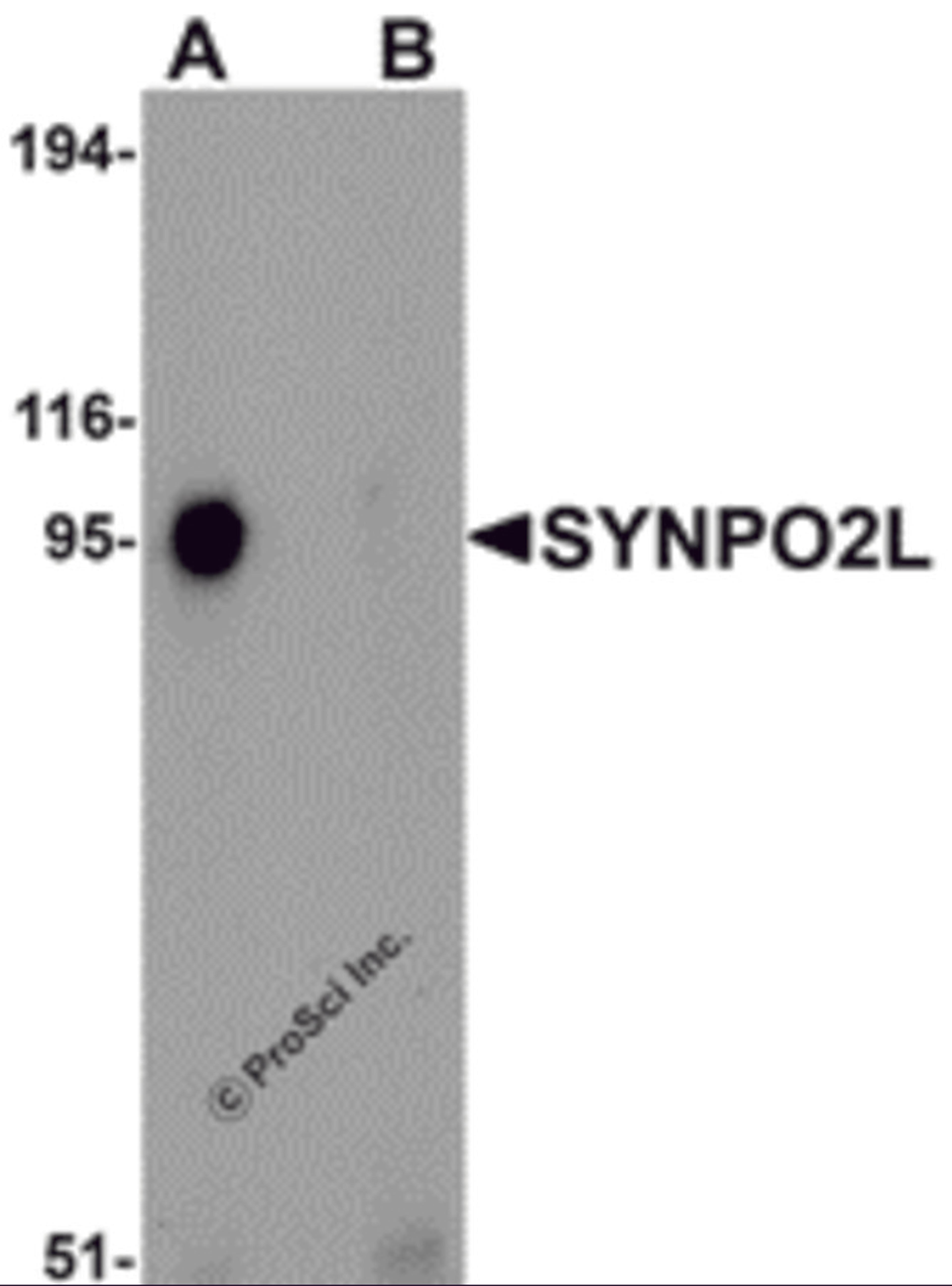 Western blot analysis of SYNPO2L in human thymus tissue lysate with SYNPO2L antibody at 1 μg/mL in (A) the absence and (B) the presence of blocking peptide.