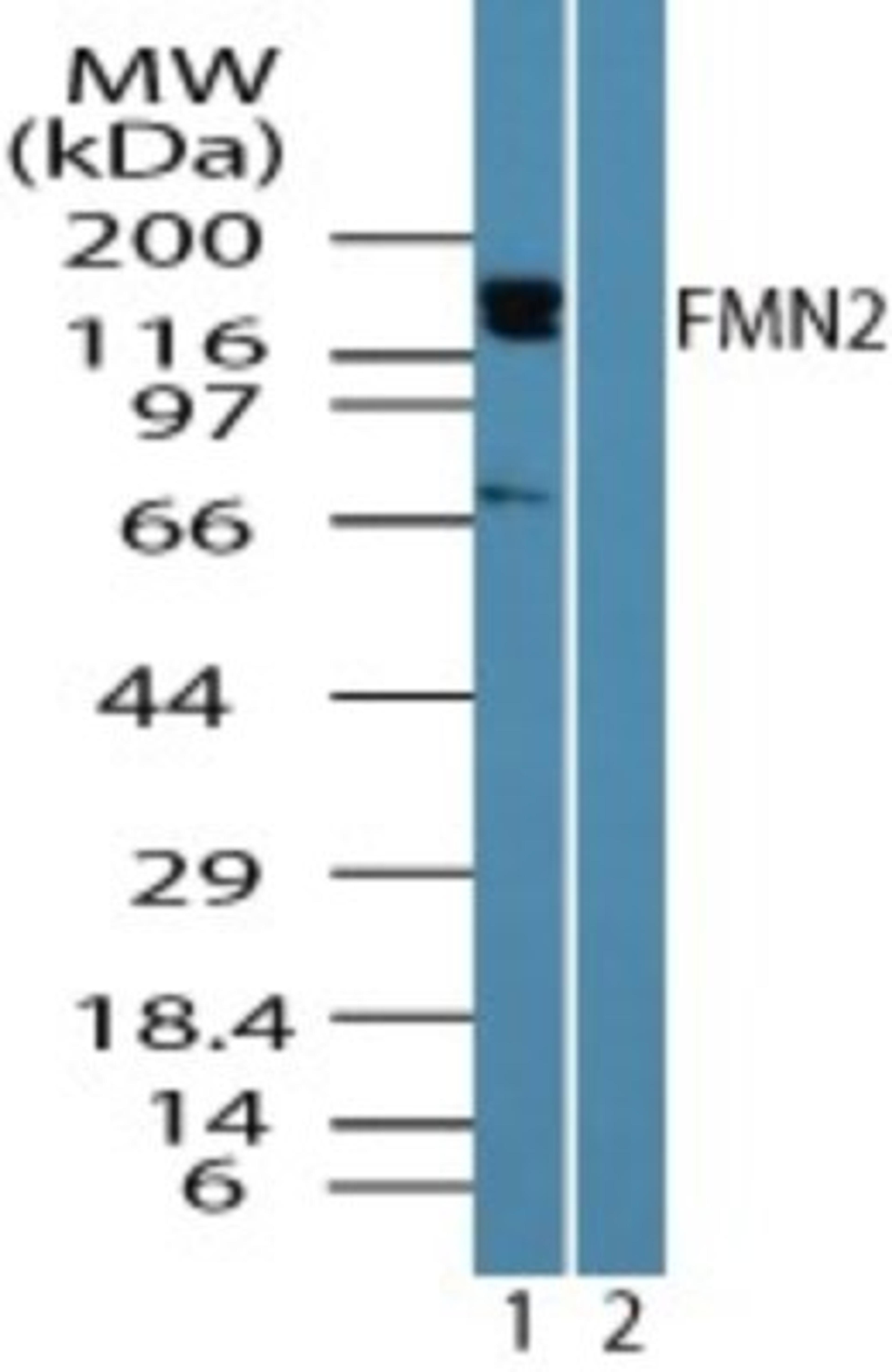 Western Blot: FMN2 Antibody [NBP2-24615] - Analysis of FMN2 in human brain lysate in the 1) absence and 2) presence of immunizing peptide using NBP2-24615 at 0.25 ug/ml.