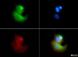 Immunocytochemistry/Immunofluorescence: VLDL Receptor Antibody (6A6) [NBP1-78162] - VLDL Receptor antibody was tested in HeLa cells with FITC (green). Nuclei and actin were counterstained with Dapi (blue) and Phalloidin (red).