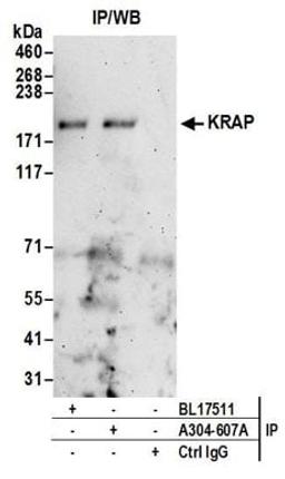 Detection of human KRAP by western blot of immunoprecipitates.