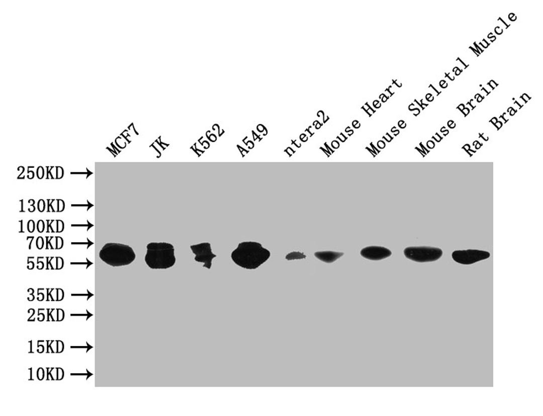 Western Blot. Positive WB detected in: NIH/3T3 whole cell lysate, MCF-7 whole cell lysate, ntera-2 whole cell lysate, Mouse brain tissue. All lanes: PAK1 antibody at 1:2000. Secondary. Goat polyclonal to rabbit IgG at 1/50000 dilution. Predicted band size: 61, 62 kDa. Observed band size: 61 kDa. 