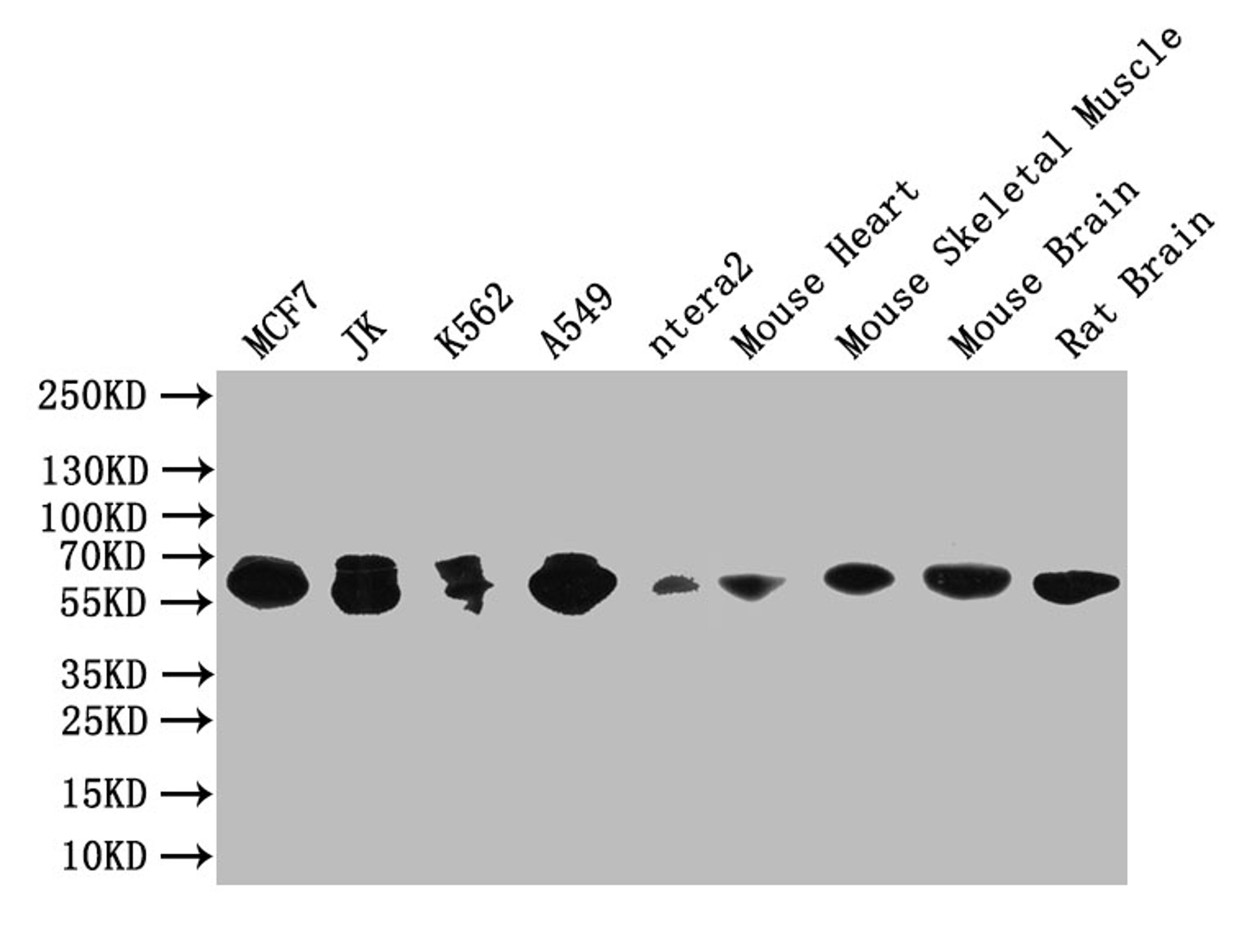 Western Blot. Positive WB detected in: NIH/3T3 whole cell lysate, MCF-7 whole cell lysate, ntera-2 whole cell lysate, Mouse brain tissue. All lanes: PAK1 antibody at 1:2000. Secondary. Goat polyclonal to rabbit IgG at 1/50000 dilution. Predicted band size: 61, 62 kDa. Observed band size: 61 kDa. 