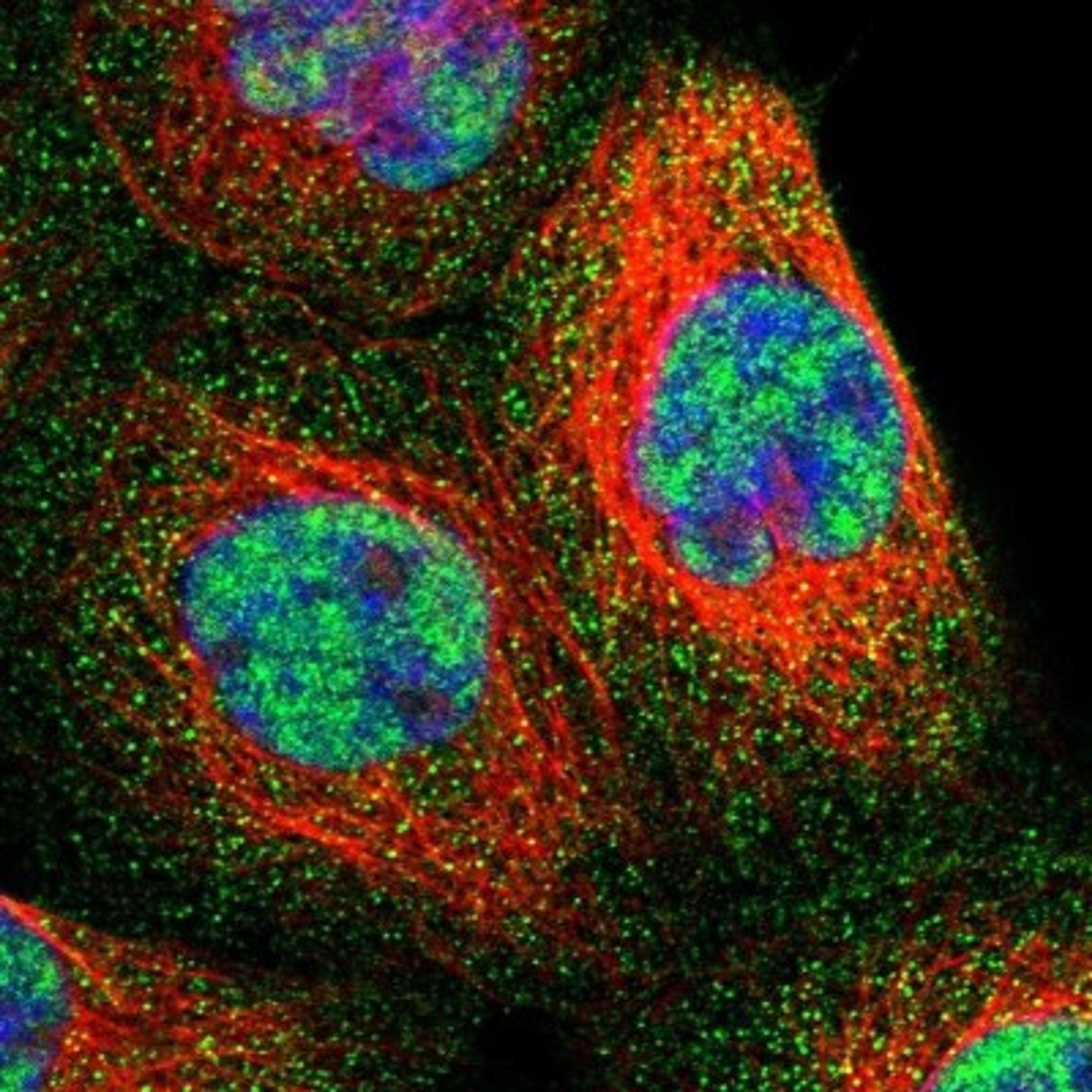 Immunocytochemistry/Immunofluorescence: ZNHIT6 Antibody [NBP1-88683] - Staining of human cell line A-431 shows positivity in nucleus but not nucleoli & cytoplasm.