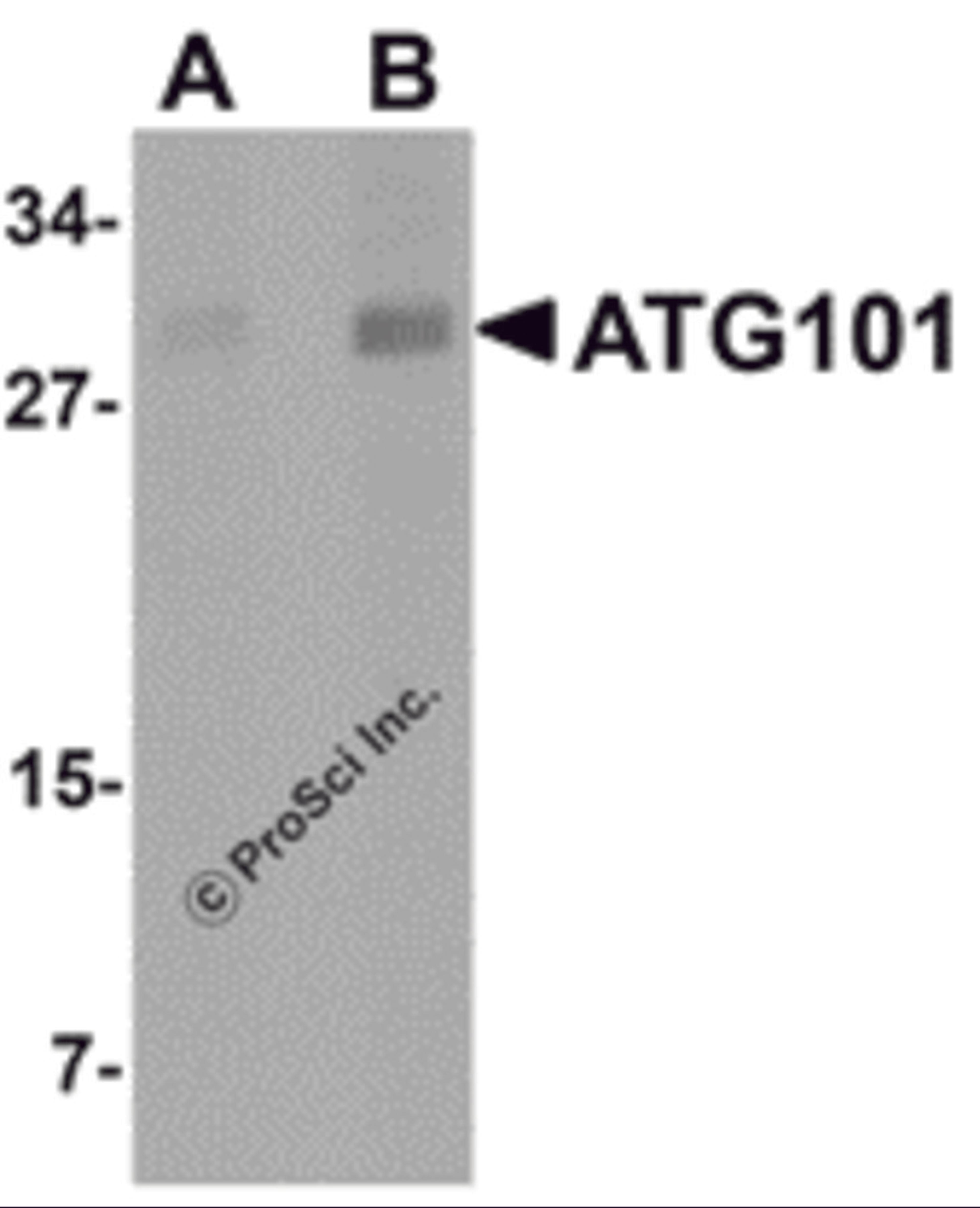 Western blot analysis of ATG101 in human liver tissue lysate with ATG101 antibody at (A) 1 and (B) 2 &#956;g/mL.