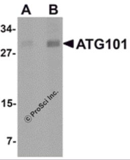 Western blot analysis of ATG101 in human liver tissue lysate with ATG101 antibody at (A) 1 and (B) 2 μg/mL.