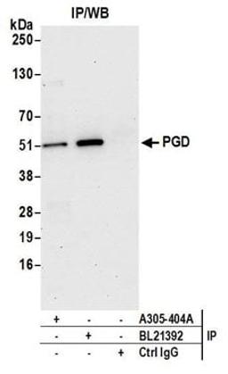 Detection of human PGD by western blot of immunoprecipitates.