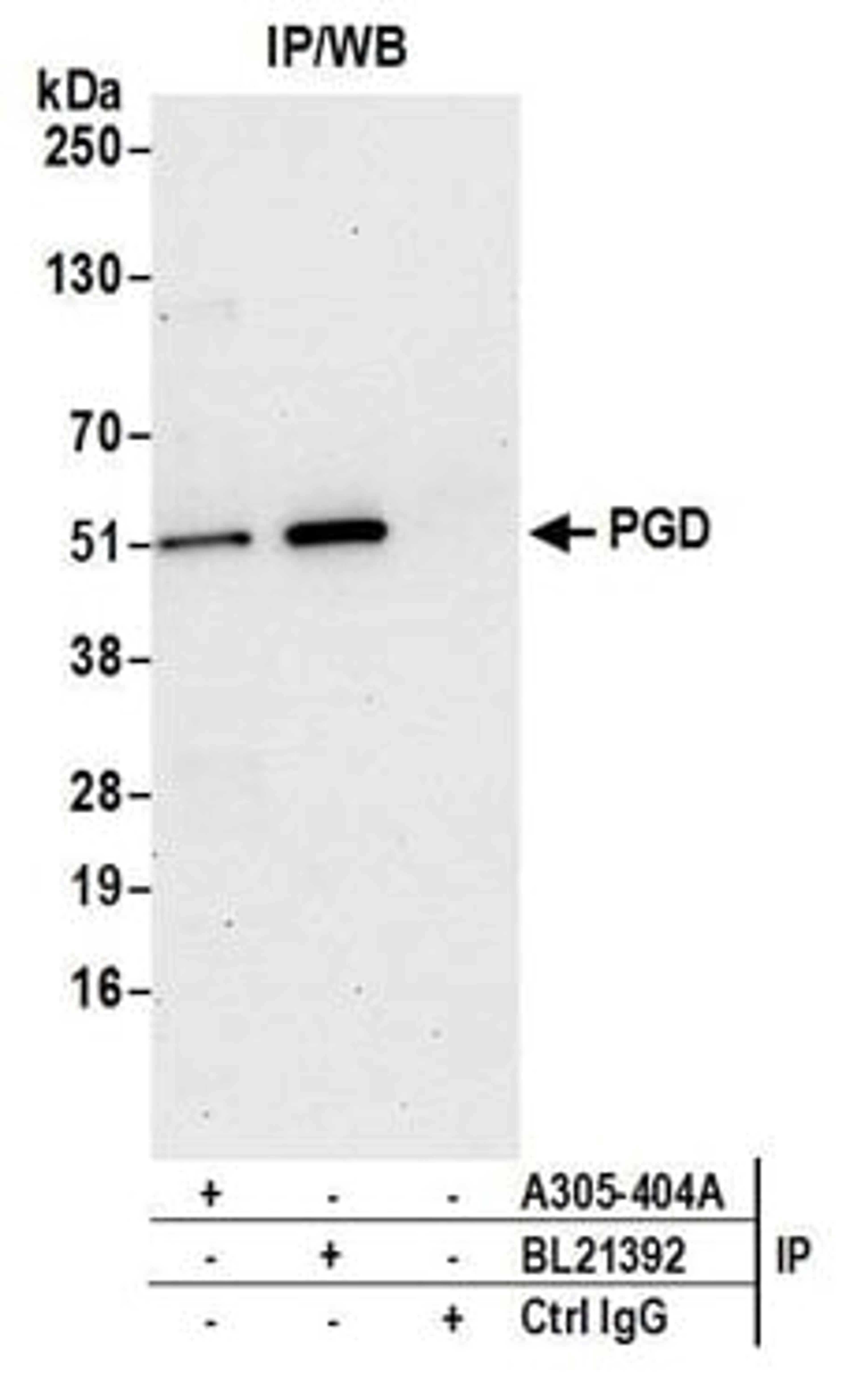 Detection of human PGD by western blot of immunoprecipitates.