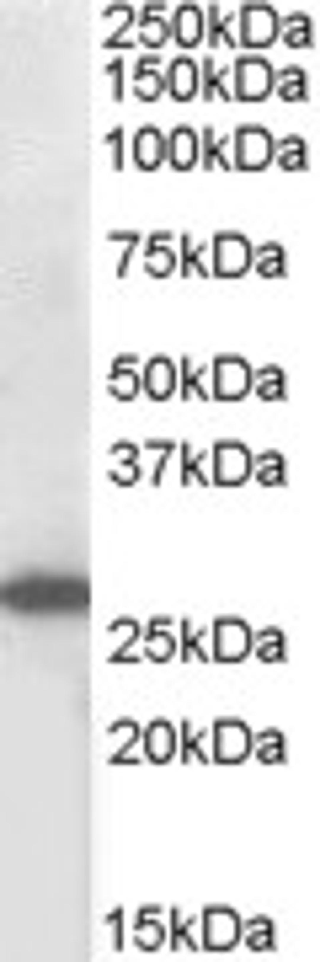 46-409 (1ug/ml) staining of MOLT4 lysate (35ug protein in RIPA buffer). Primary incubation was 1 hour. Detected by chemiluminescence.