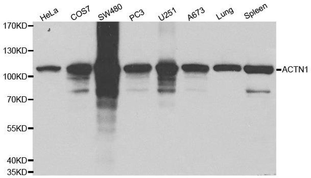 Western blot analysis of extracts of various cell lines using ACTN1 antibody