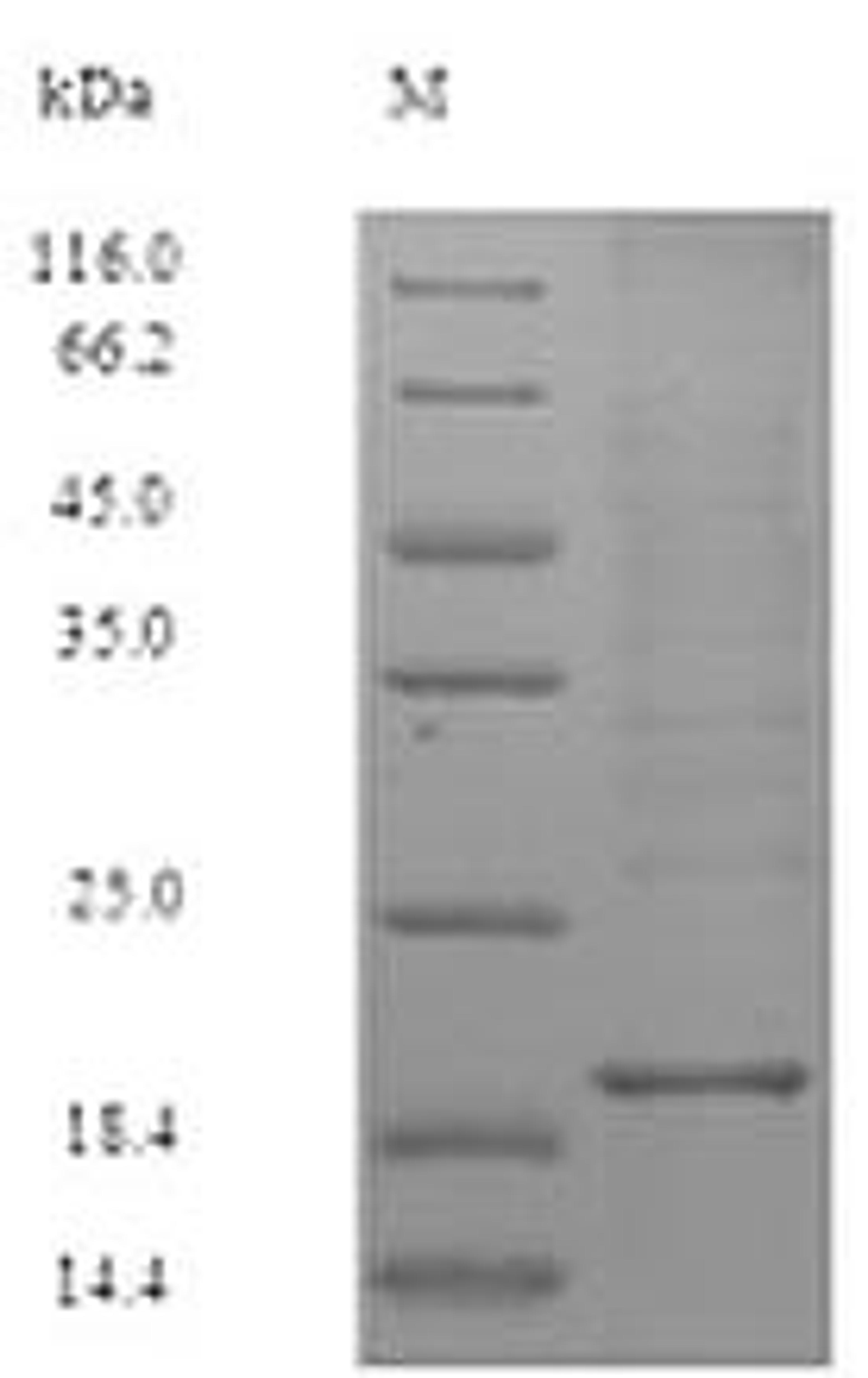 (Tris-Glycine gel) Discontinuous SDS-PAGE (reduced) with 5% enrichment gel and 15% separation gel.