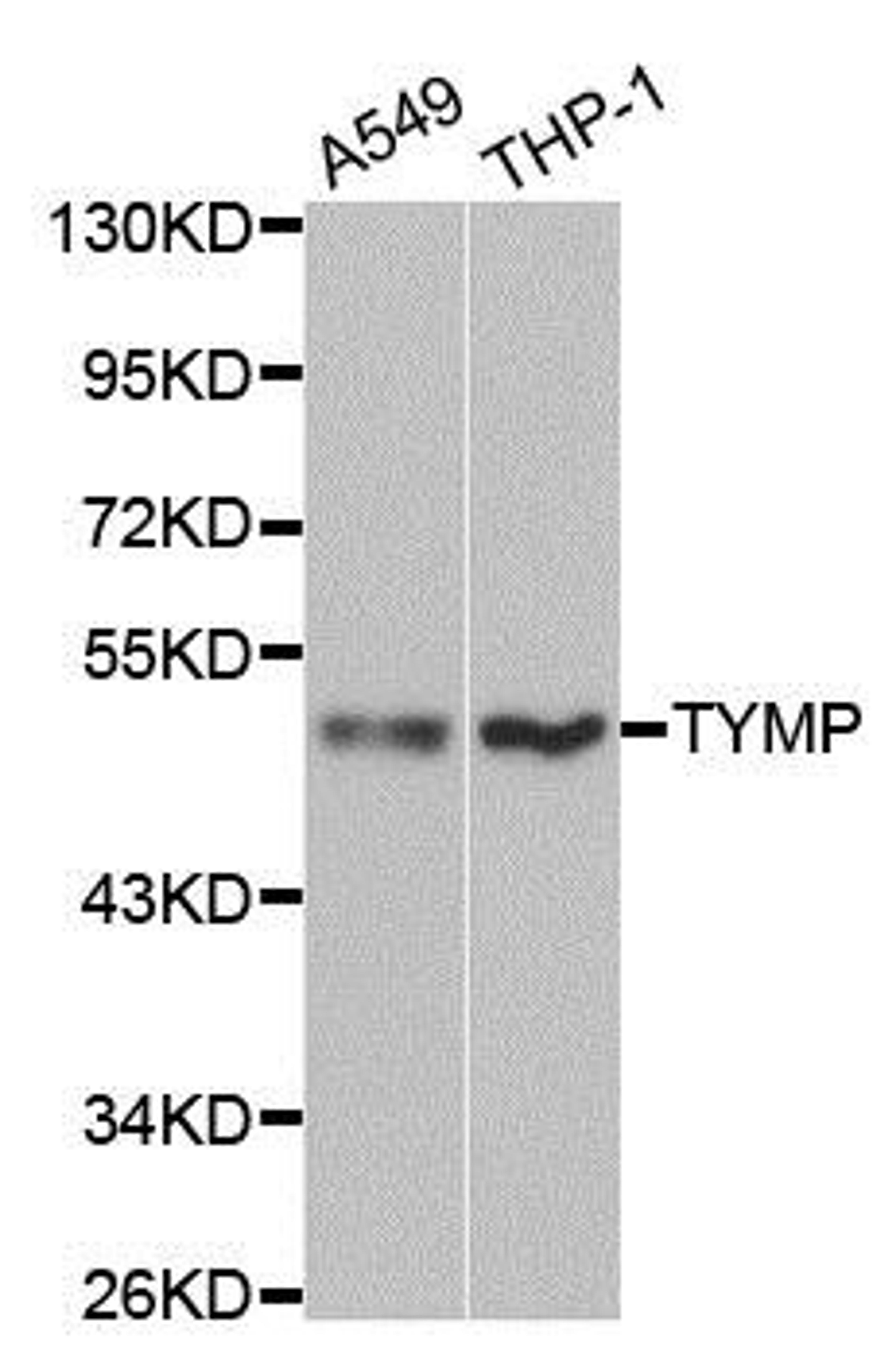 Western blot analysis of extracts of various cell lines using TYMP antibody