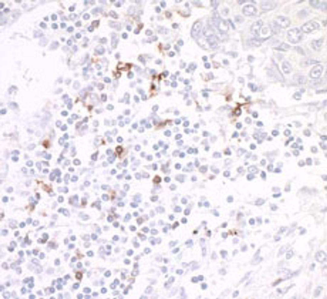 Detection of human OX40/CD134 by immunohistochemistry.