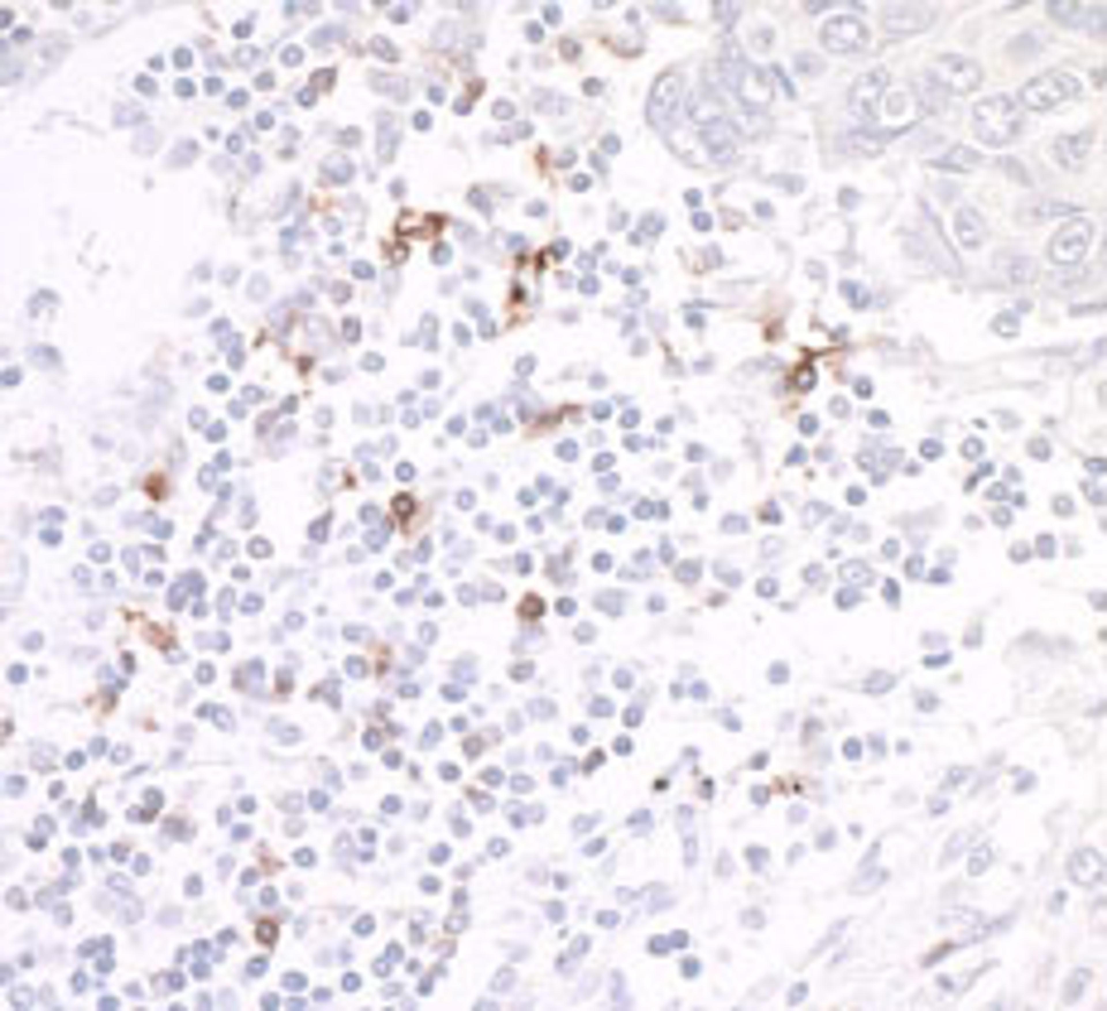 Detection of human OX40/CD134 by immunohistochemistry.