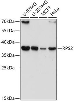 Western blot - RPS2 antibody (A6728)