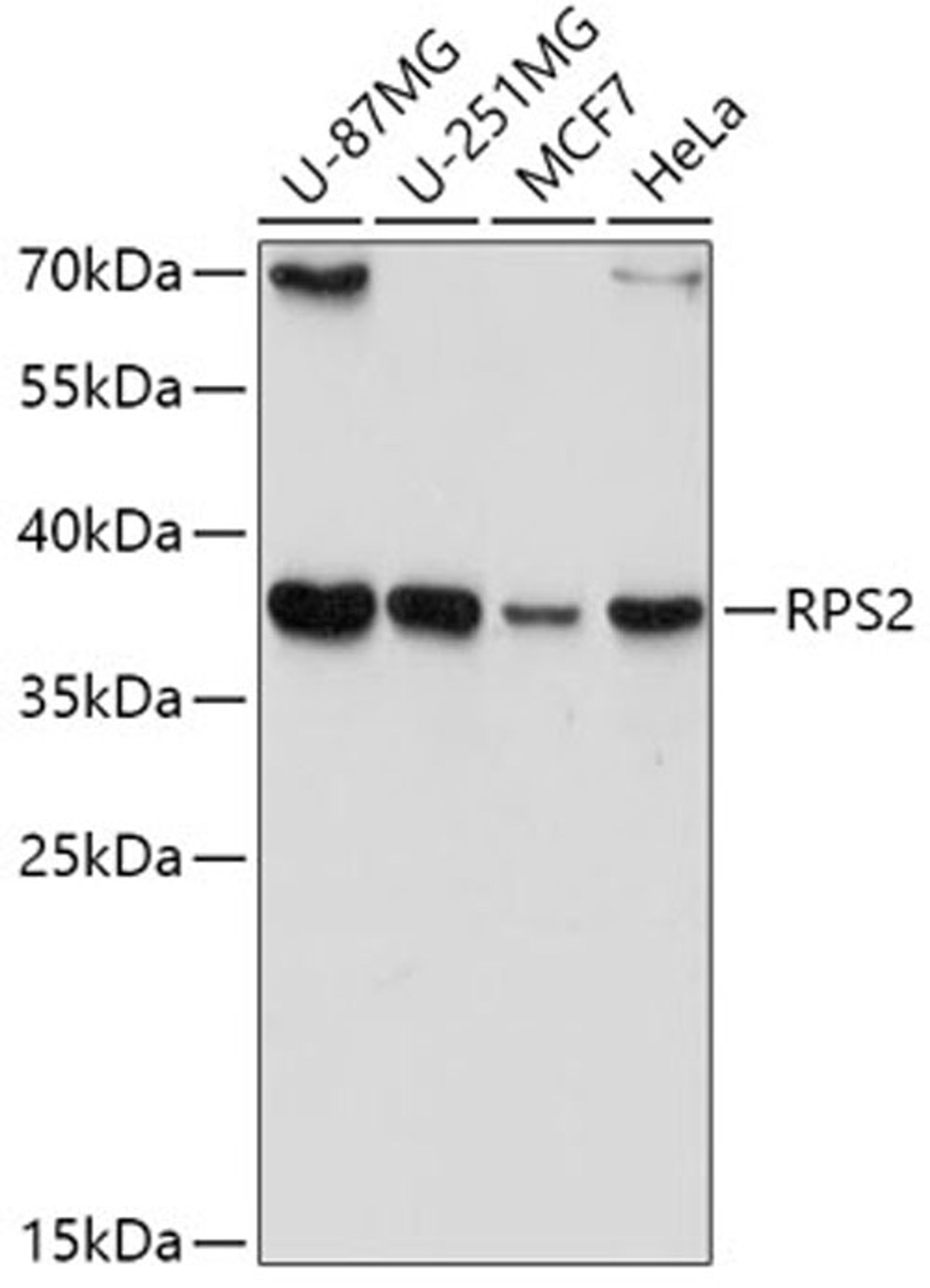 Western blot - RPS2 antibody (A6728)