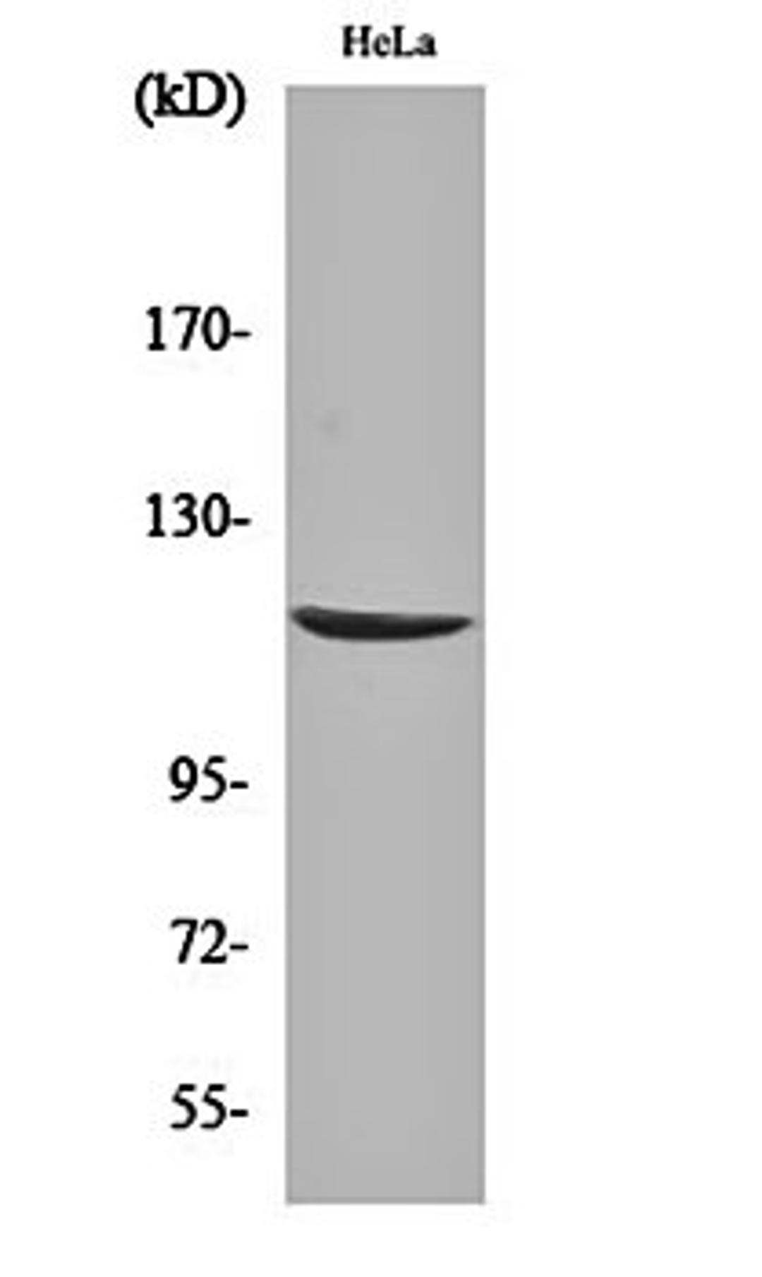 Western blot analysis of Hela cell lysates using CARD 6 antibody