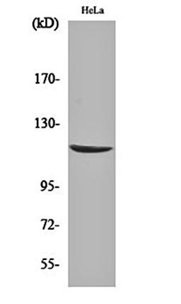 Western blot analysis of Hela cell lysates using CARD 6 antibody