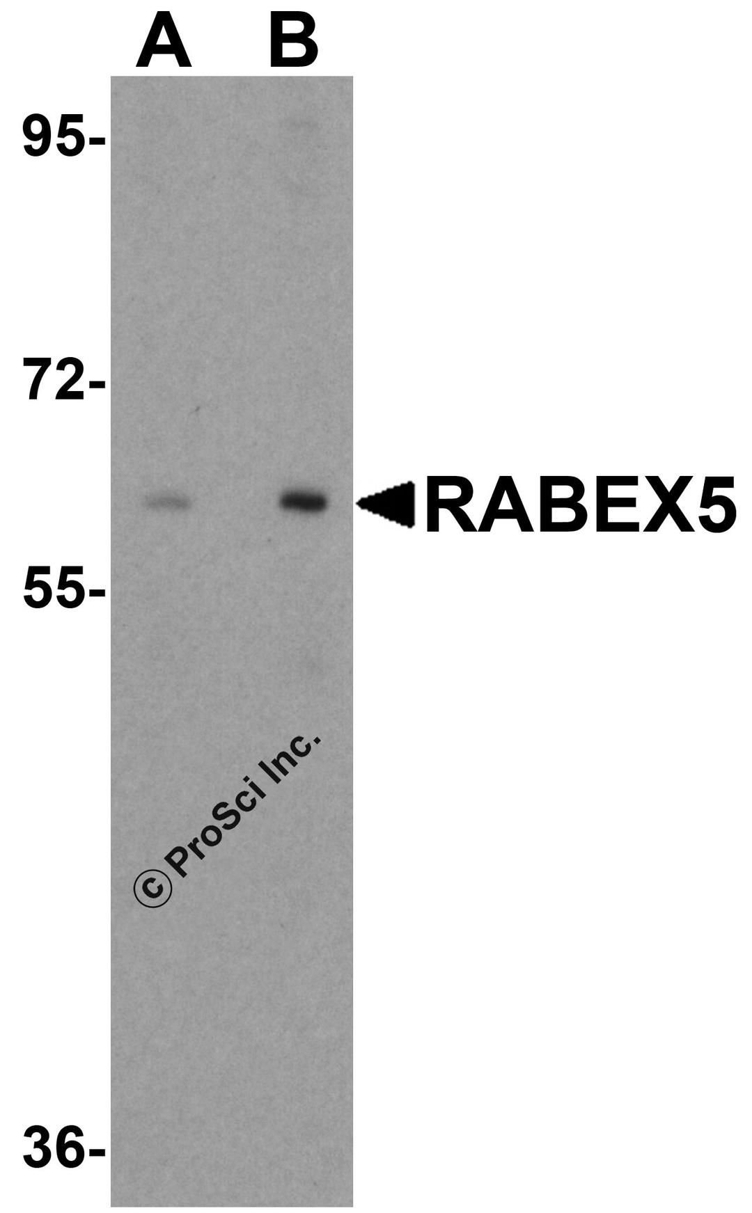 Western blot analysis of RABEX5 in human liver tissue lysate with RABEX5 antibody at (A) 1 and (B) 2 μg/mL.
