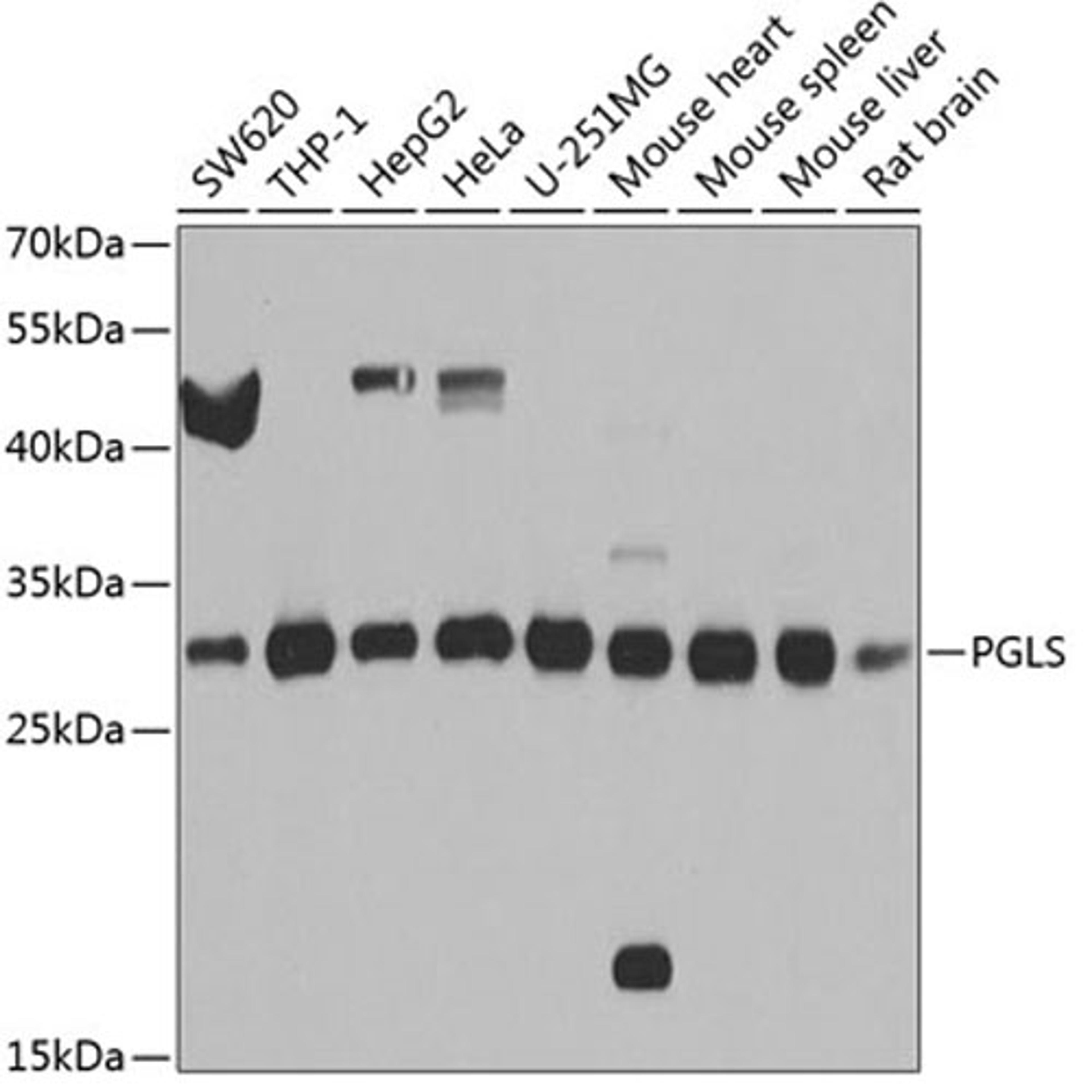 Western blot - PGLS antibody (A8366)