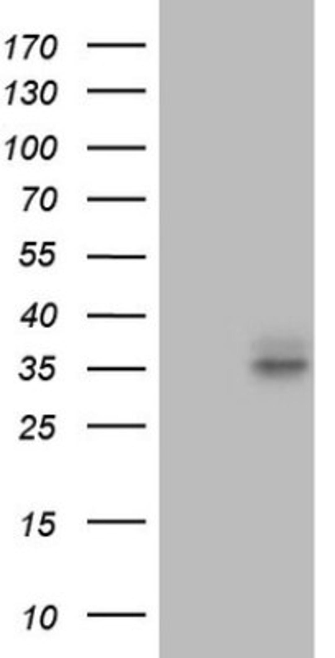 Western Blot: FOLR2 Antibody (4G6) [NBP2-45693] - Analysis of HEK293T cells were transfected with the pCMV6-ENTRY control (Left lane) or pCMV6-ENTRY FOLR2.