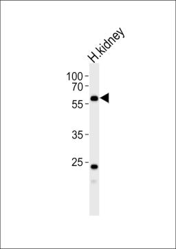 Western blot analysis of lysate from human kidney tissue lysate, using PFKFB3 Antibody (E469) at 1:1000.