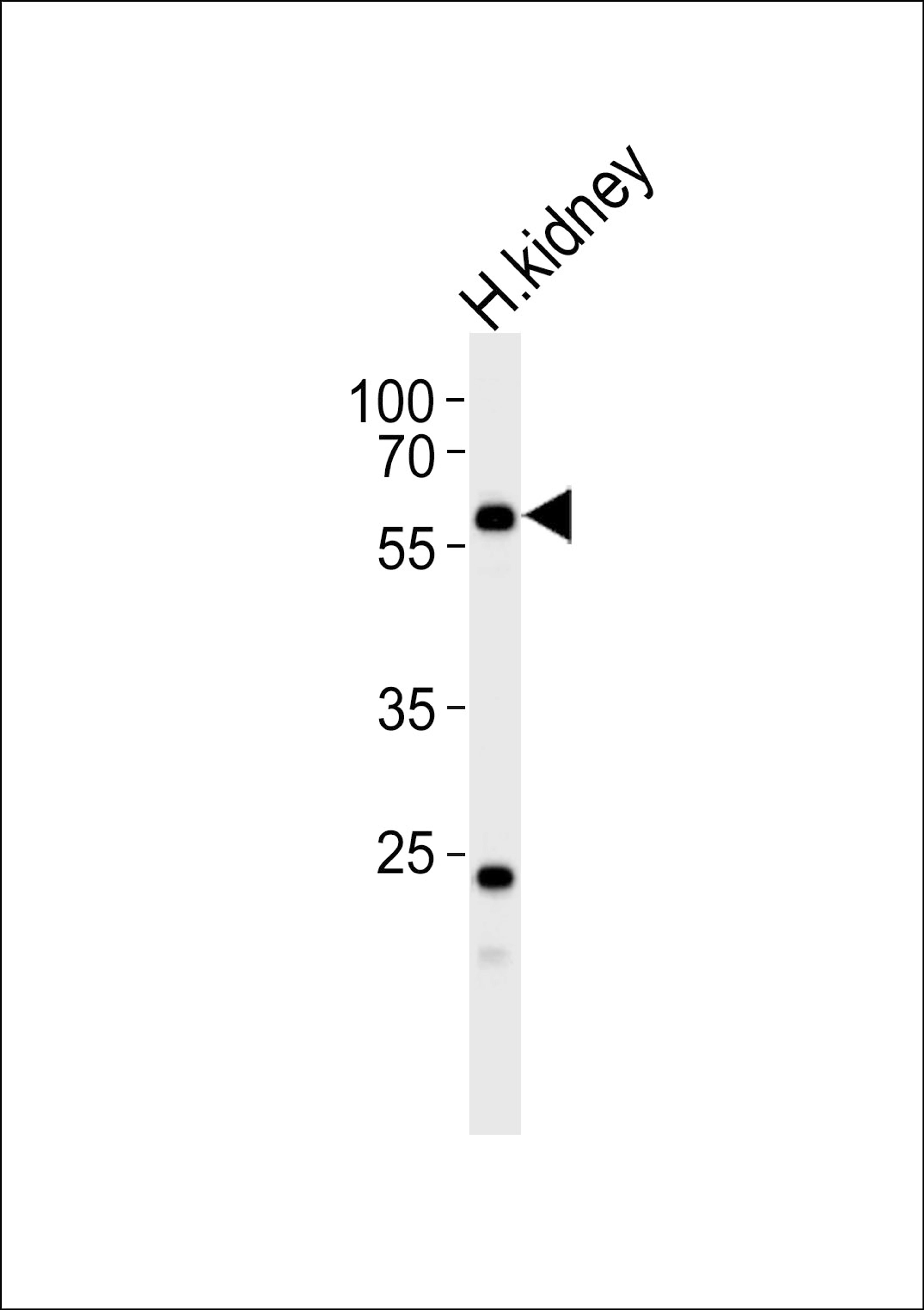 Western blot analysis of lysate from human kidney tissue lysate, using PFKFB3 Antibody (E469) at 1:1000.