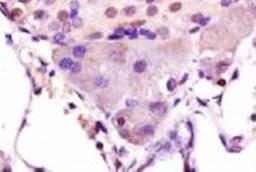 Immunohistochemical analysis of formalin-fixed paraffin embedded rat pancreas tissue using MAFA antibody (dilution at 1:200)