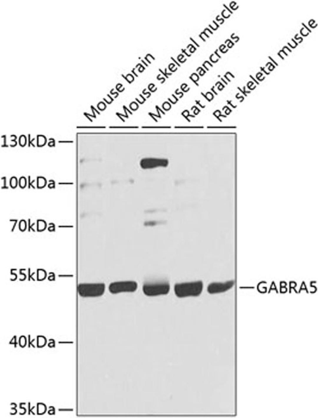 Western blot - GABRA5 antibody (A9932)