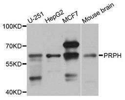 Western blot analysis of extracts of various cells using PRPH antibody