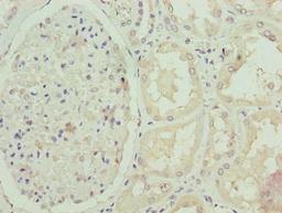 Immunohistochemistry of paraffin-embedded human kidney tissue using CSB-PA848401LA01HU at dilution of 1:100