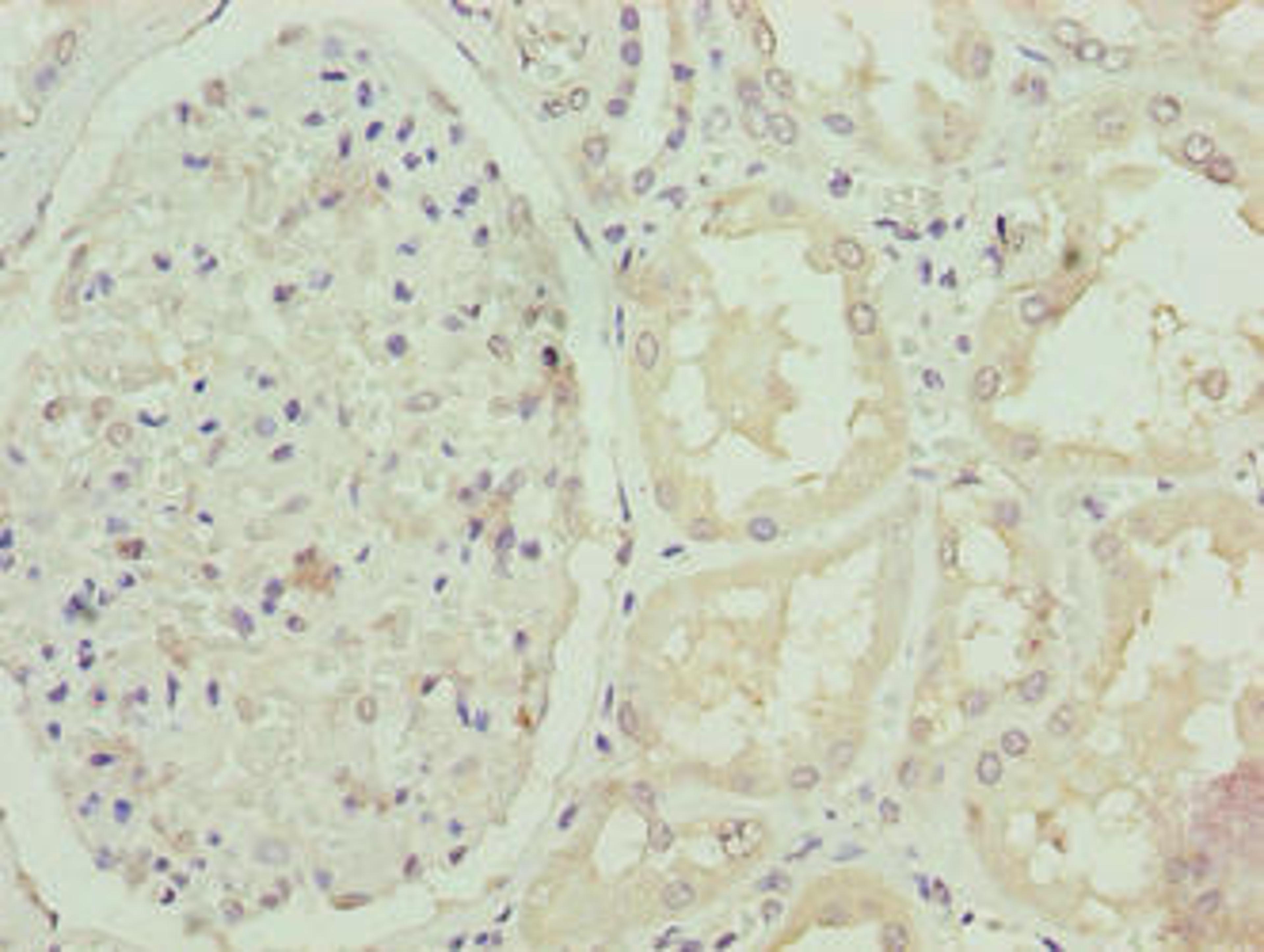 Immunohistochemistry of paraffin-embedded human kidney tissue using CSB-PA848401LA01HU at dilution of 1:100