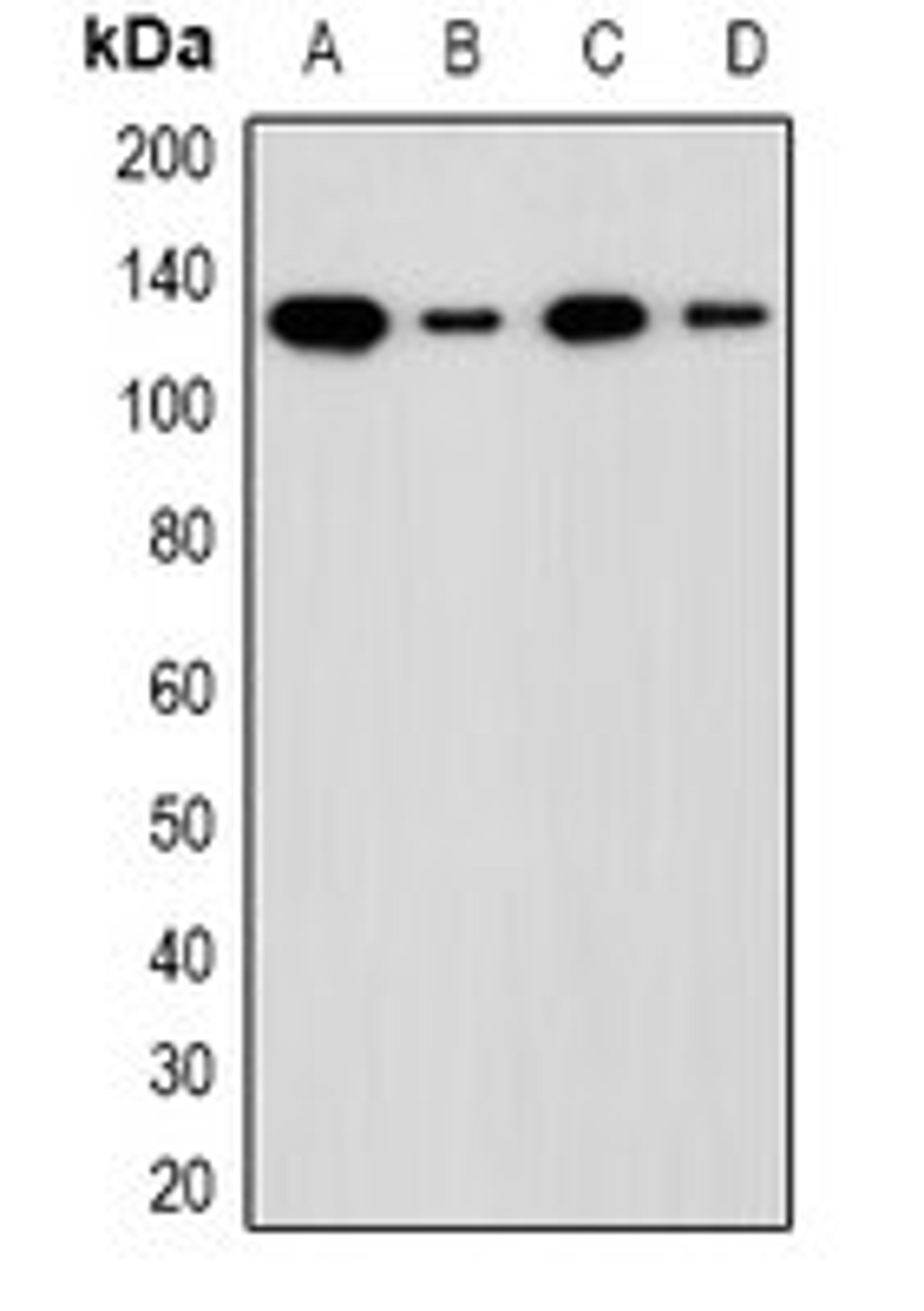 Western blot analysis of LOVO (Lane1), HCT116 (Lane2), mouse liver (Lane3), rat liver (Lane4) whole cell lysates using ADNP antibody