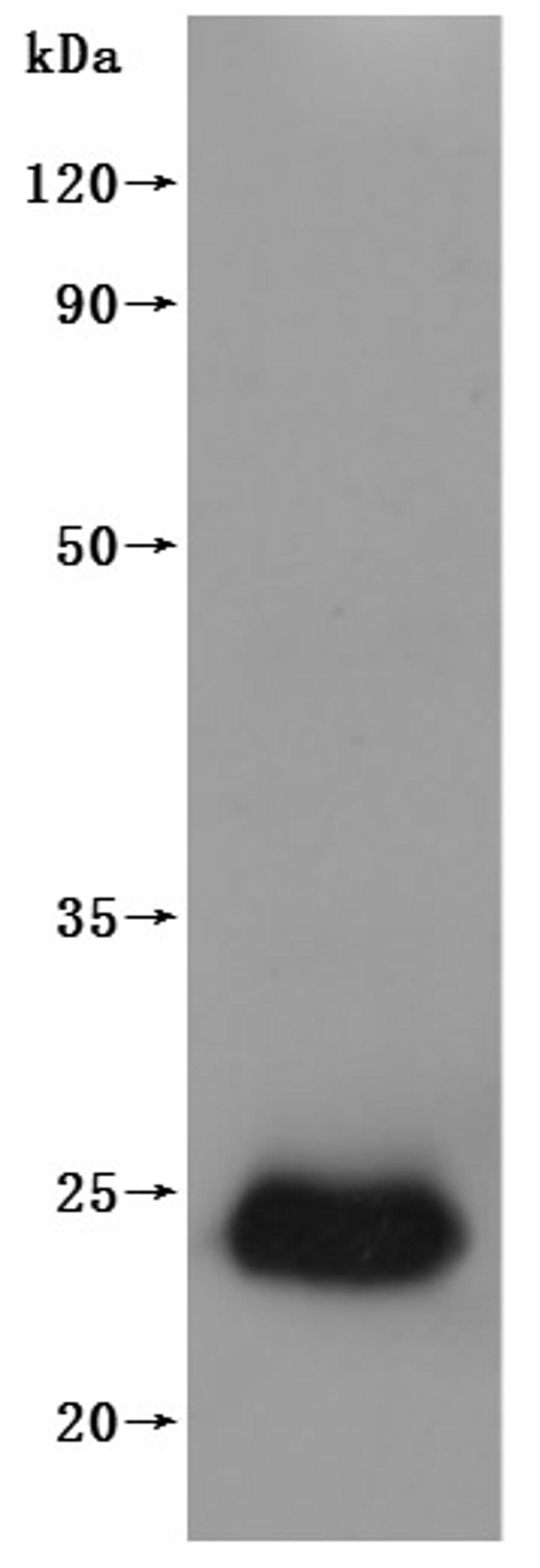 CSB-MP005508HU(A4) is detected by Mouse anti-6*His monoclonal antibody.