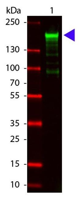 Western blot analysis of Alpha-2-Macroglobulin (Lane1), none (Lane2) Load: 100 ng per lane using Alpha-2-Macroglobulin antibody