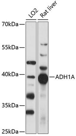 Western blot - ADH1A antibody (A14701)