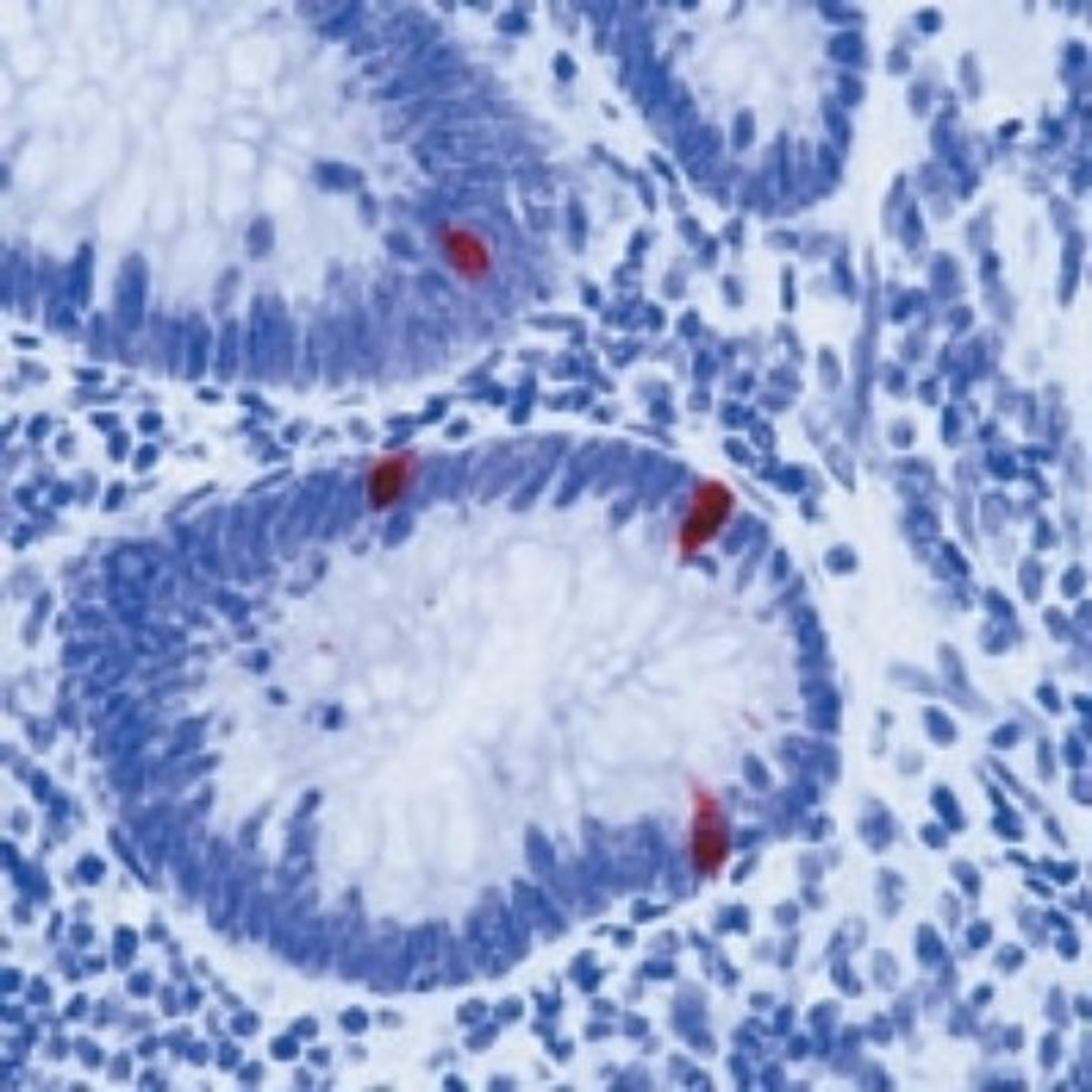 Immunohistochemistry: Serotonin Antibody (5HT-H209) [NB120-16007] - Formalin-fixed, paraffin-embedded human appendix stained with Serotonin (NB120-16007) using peroxidase-conjugate and AEC chromogen. Note cytoplasmic staining of serotonin-secreting cells.