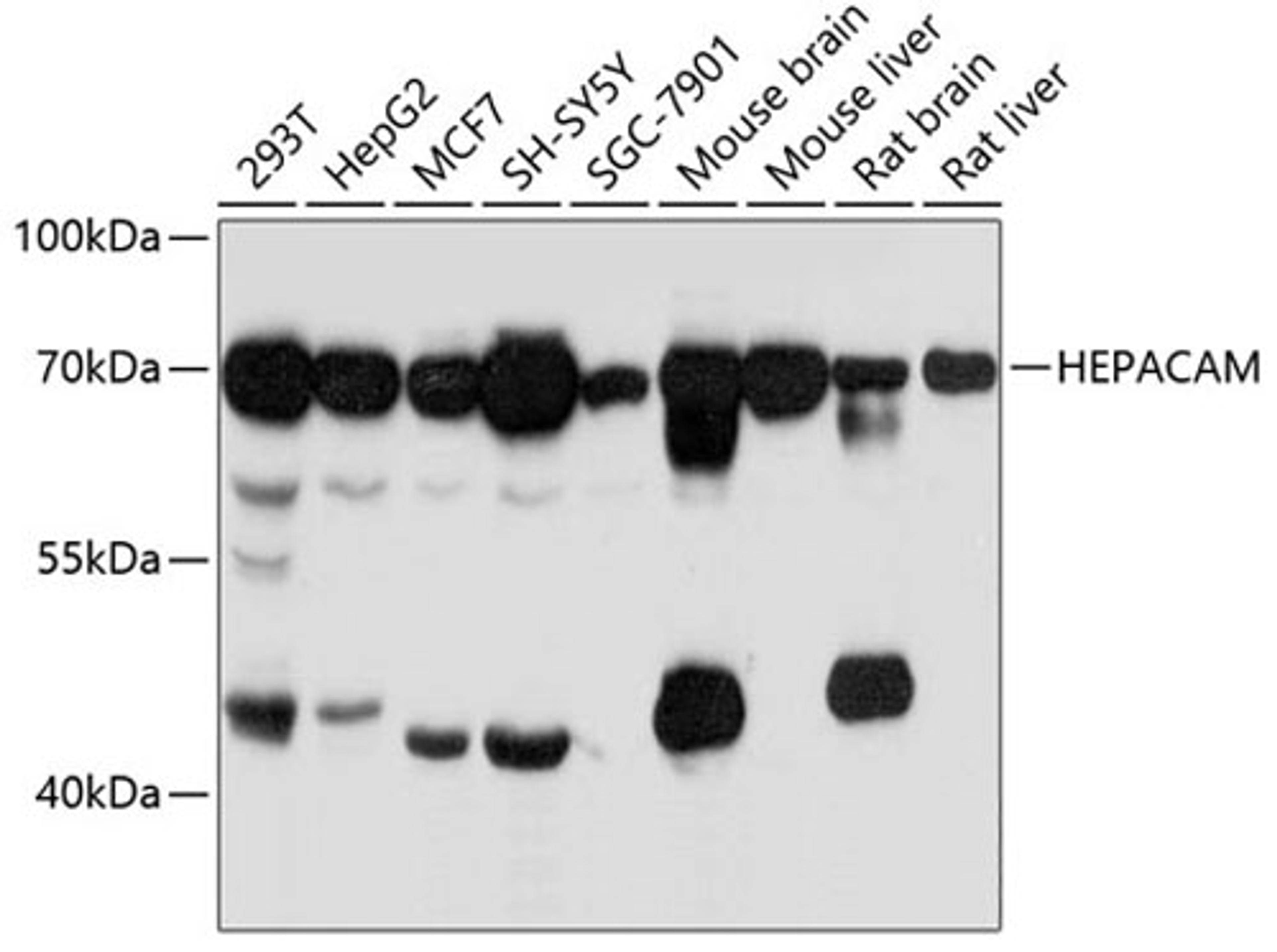 Western blot - HEPACAM antibody (A11589)