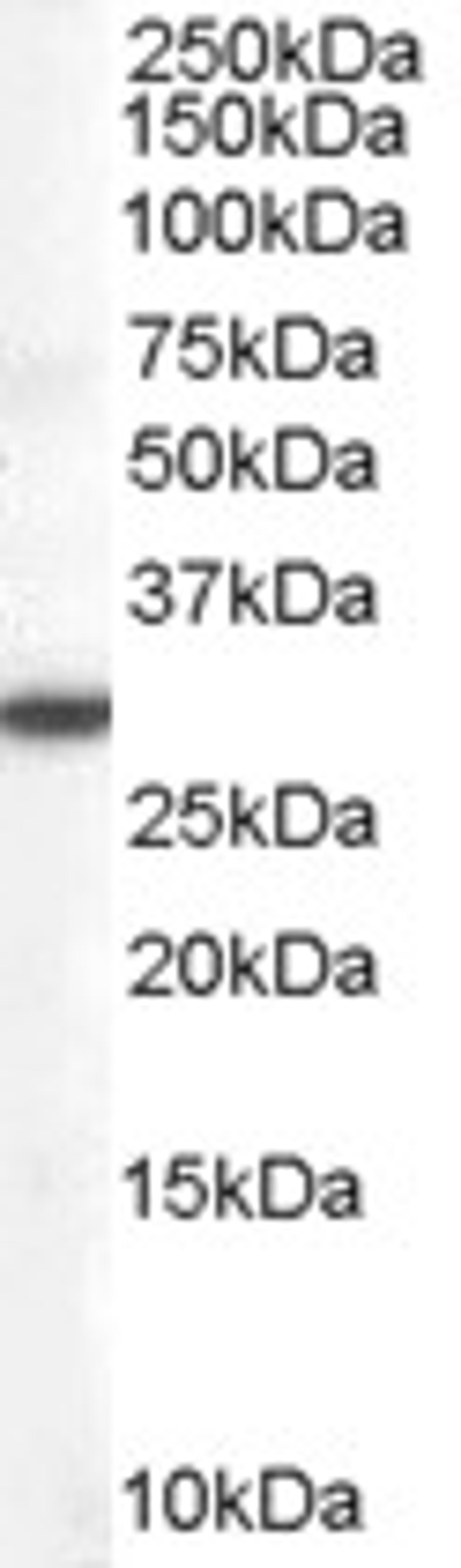 45-469 (0.1ug/ml) staining of Human Lung lysate (35ug protein in RIPA buffer). Primary incubation was 1 hour. Detected by chemiluminescence.