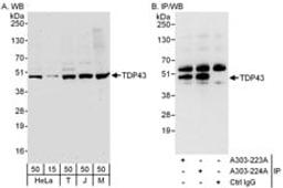 Detection of human and mouse TDP43 by western blot (h and m) and immunoprecipitation (h).