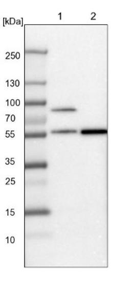 Western Blot: SH2D4A Antibody [NBP1-82157] - Lane 1: Mouse liver tissue lysate<br/>Lane 2: Rat liver tissue lysate