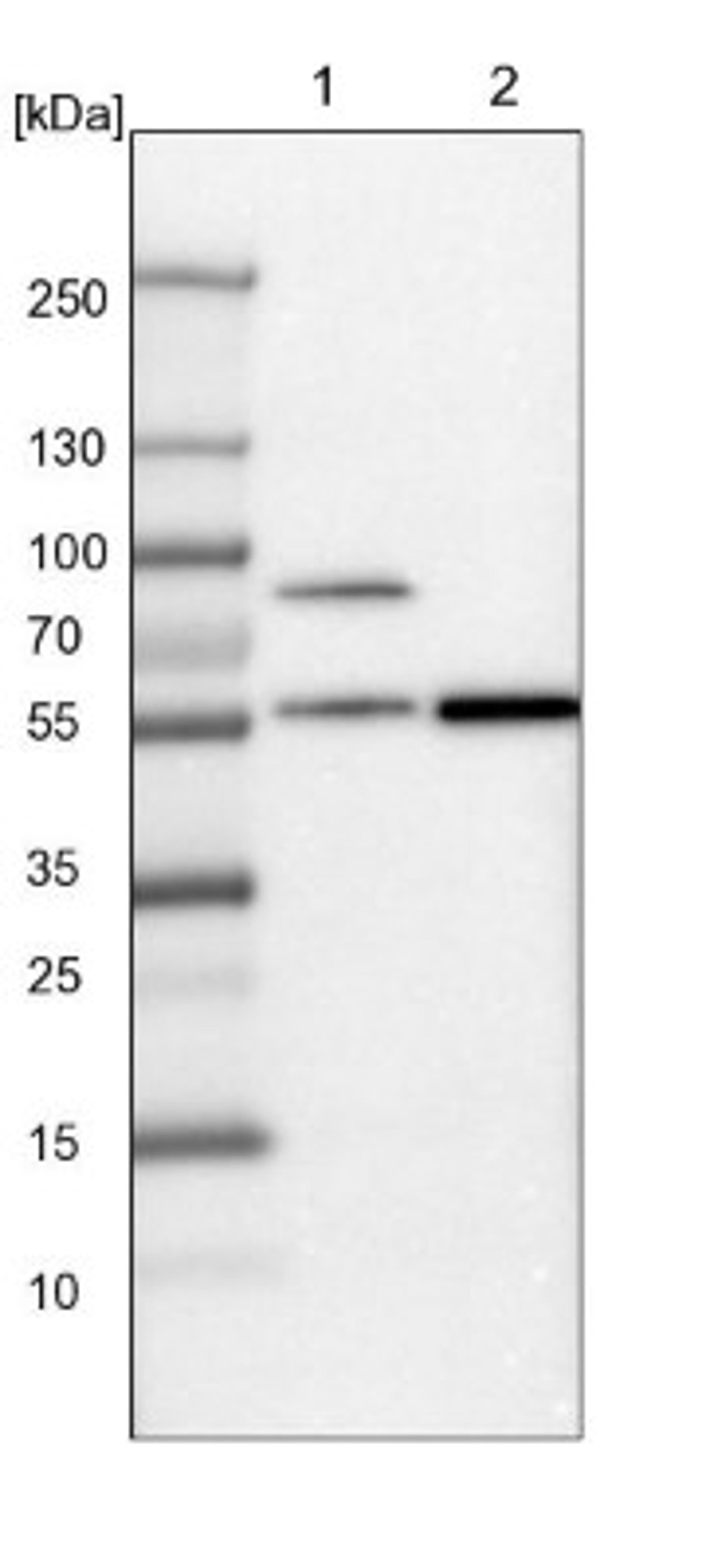 Western Blot: SH2D4A Antibody [NBP1-82157] - Lane 1: Mouse liver tissue lysate<br/>Lane 2: Rat liver tissue lysate