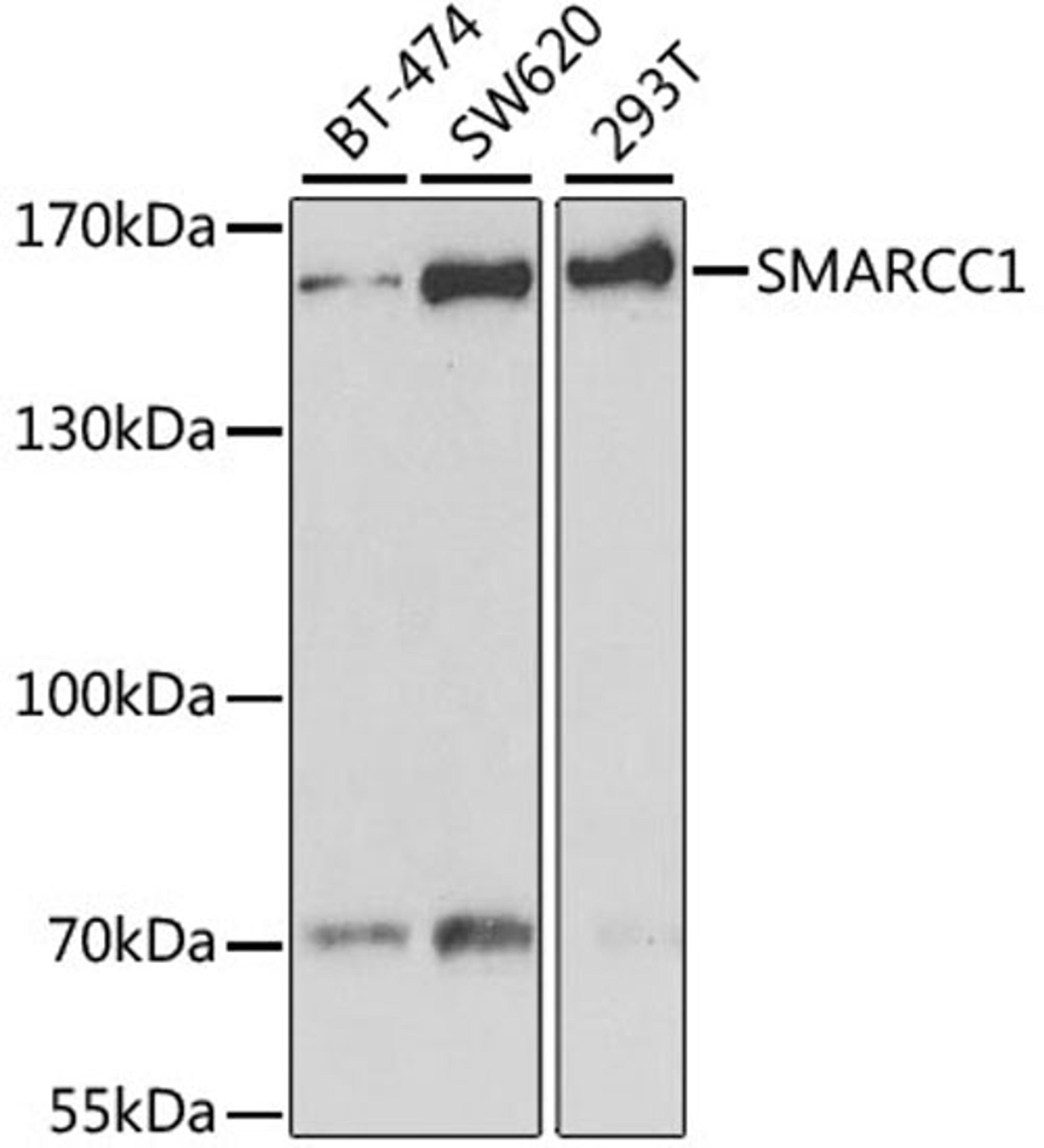 Western blot - SMARCC1 antibody (A6128)