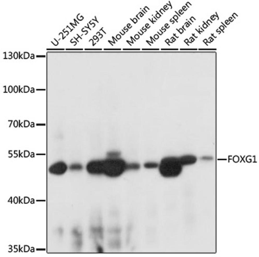 Western blot - FOXG1 antibody (A16851)