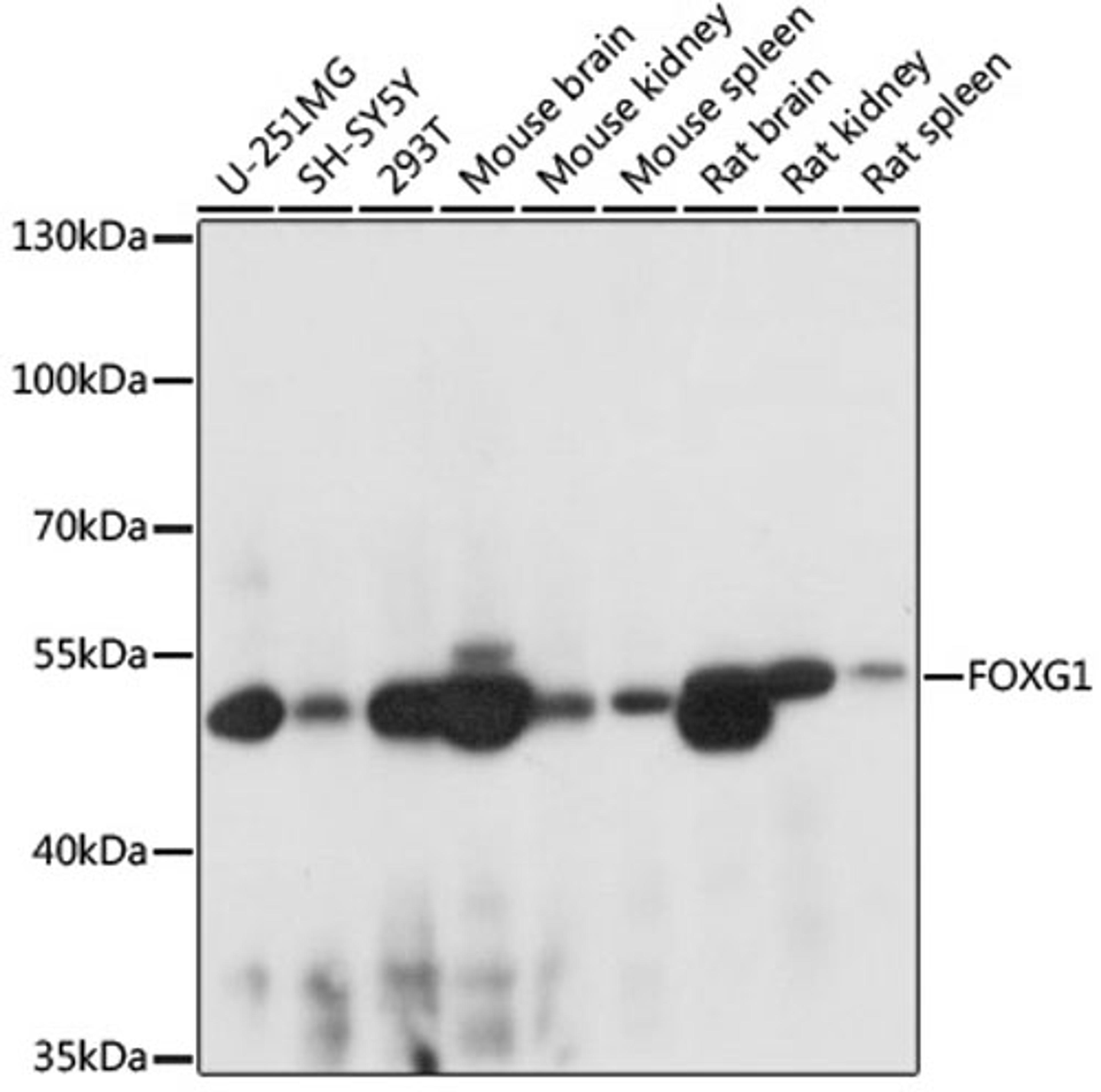 Western blot - FOXG1 antibody (A16851)