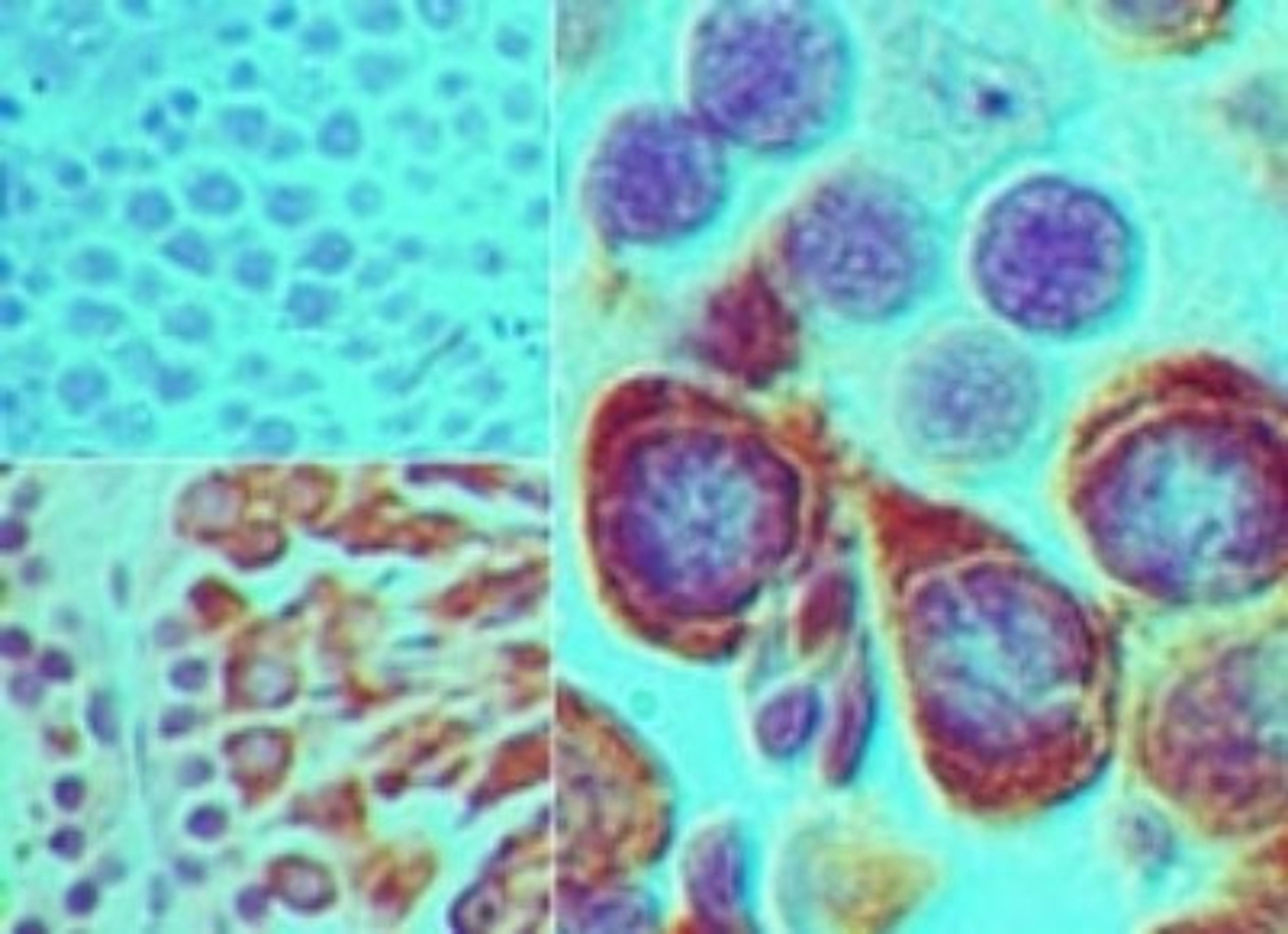 Immunohistochemistry-Paraffin: PIWIL2 Antibody [NBP2-24590] - Immunohistochemical analysis of PIWIL2 in formalin-fixed, paraffin-embedded mouse testis tissue using an isotype control (top left) and NBP2-24590 (bottom left, right) at 5 ug/ml.